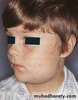 salivary glands