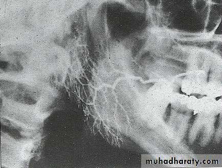salivary glands