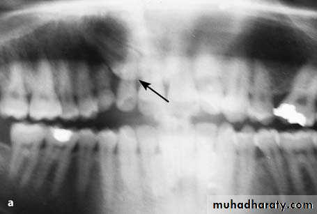 surgical aids in ortho