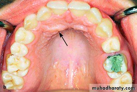 surgical aids in ortho