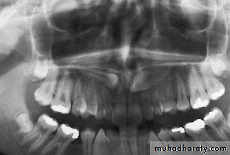 surgical aids in ortho