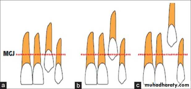 surgical aids in ortho