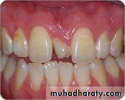 surgical aids in ortho