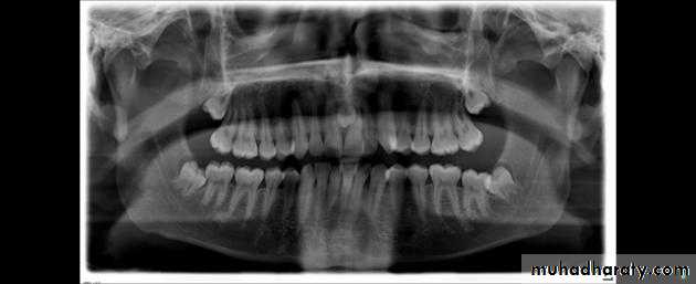 surgical aids in ortho