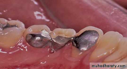 surgical aids in ortho
