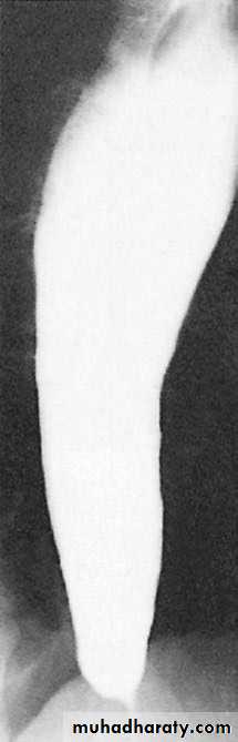 Esophagus 2