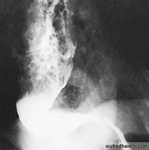 Esophagus 2