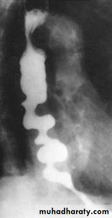 Esophagus 2