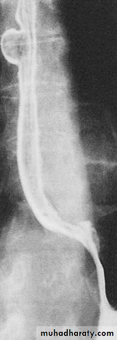 Esophagus 2