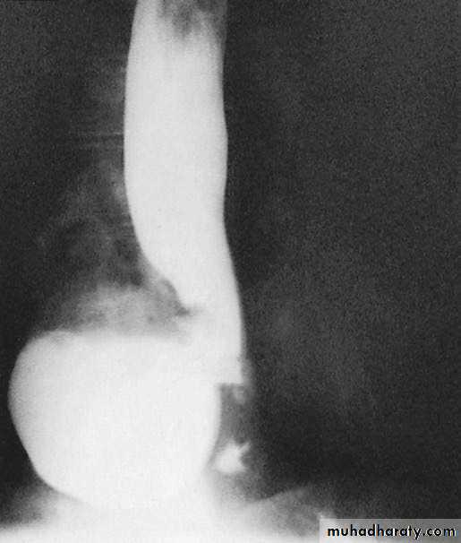 Esophagus 2