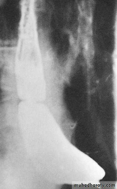 Esophagus 2