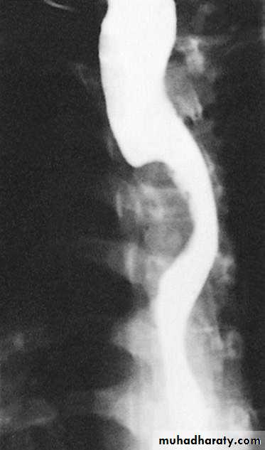 Esophagus 2