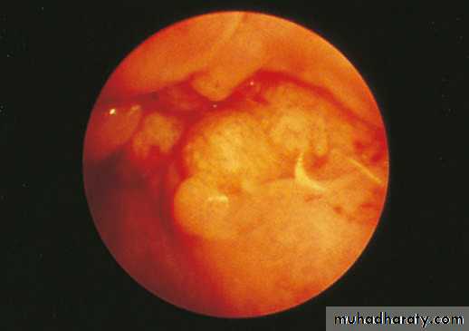Esophagus 2