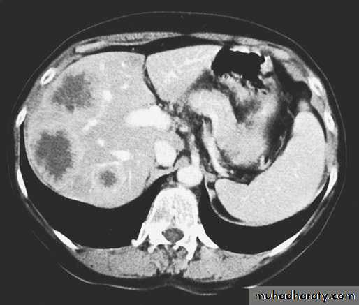 Esophagus 2