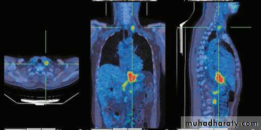 Esophagus 2