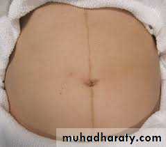 Overview of normal development of the fetus