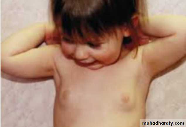 Puberty