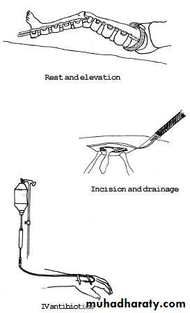 Bone infection