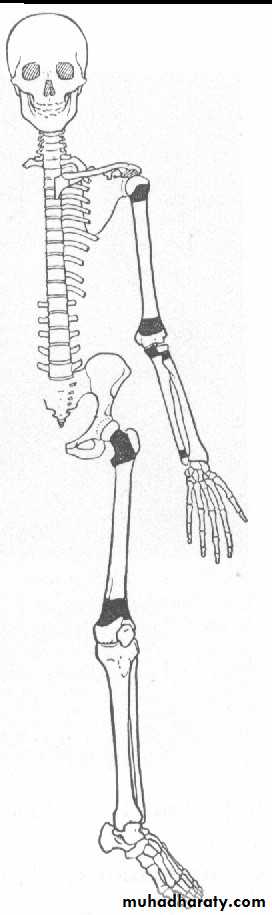 Bone infection