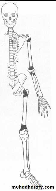 Bone infection