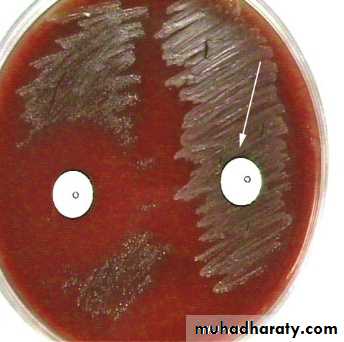 Bone infection