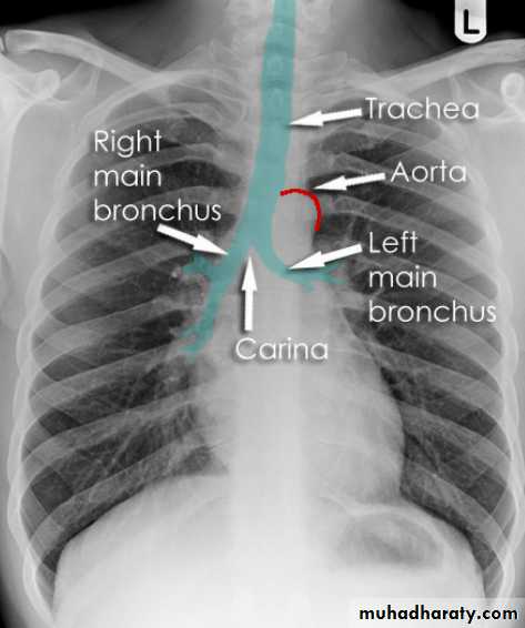 Chest Imaging