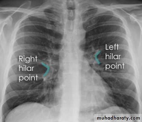 Chest Imaging