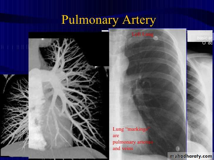 Chest Imaging