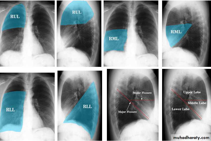 Chest Imaging