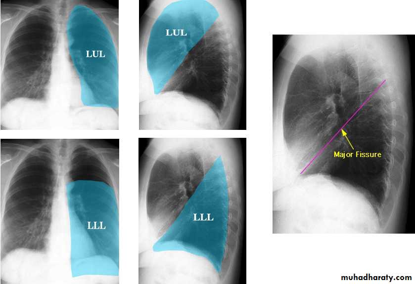 Chest Imaging
