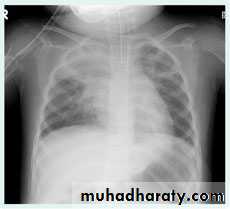 Chest Imaging