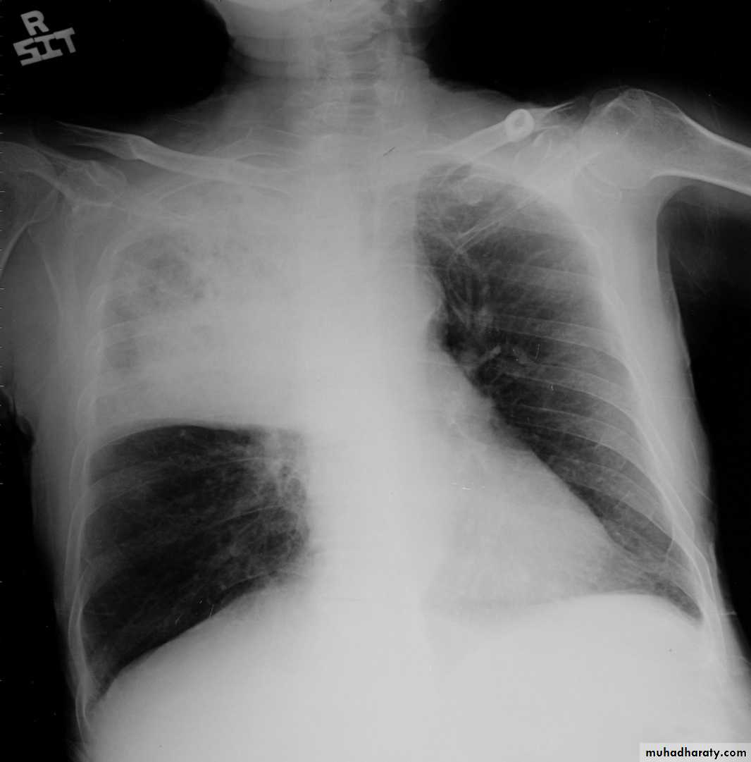 Chest Imaging