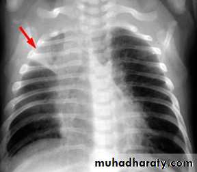 Chest Imaging
