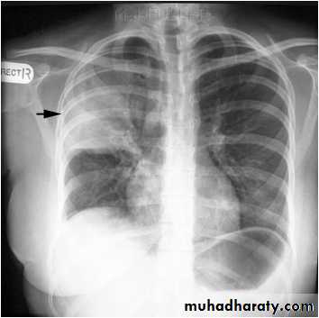 Chest Imaging