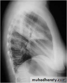 Chest Imaging