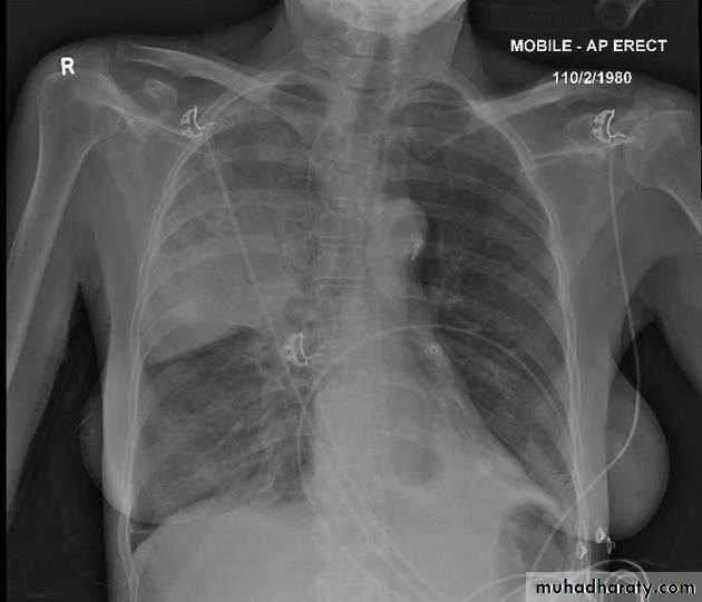 Chest Imaging