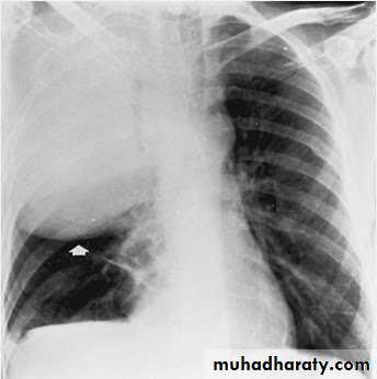 Chest Imaging
