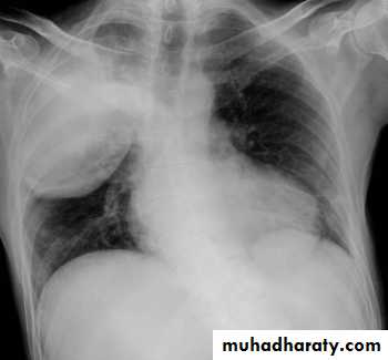 Chest Imaging