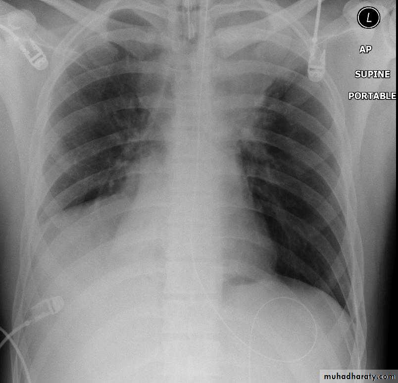 Chest Imaging
