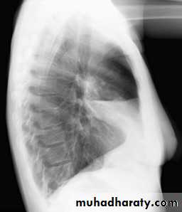Chest Imaging