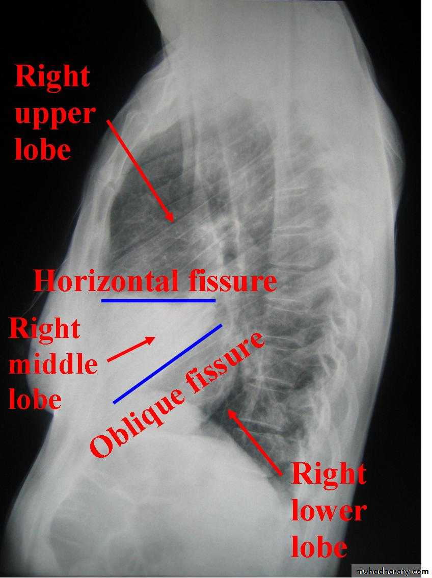 Chest Imaging