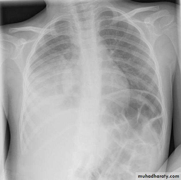 Chest Imaging
