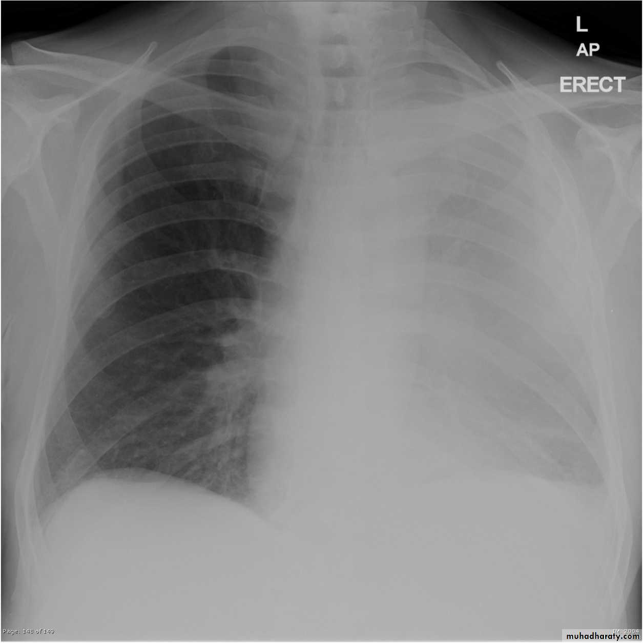 Chest Imaging