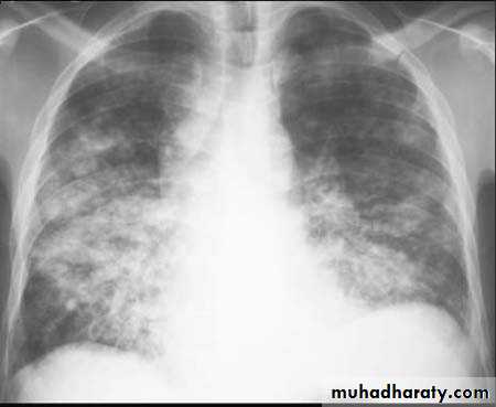 Chest Imaging