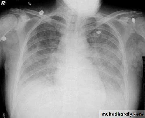 Chest Imaging
