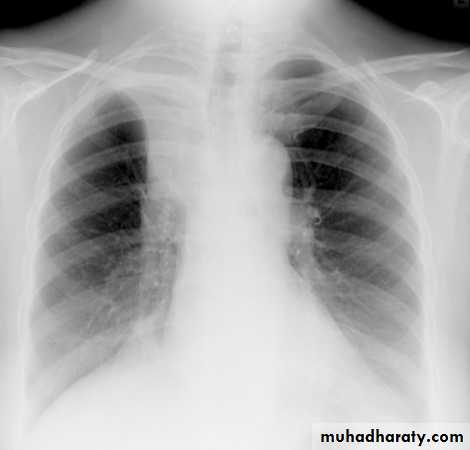Chest Imaging