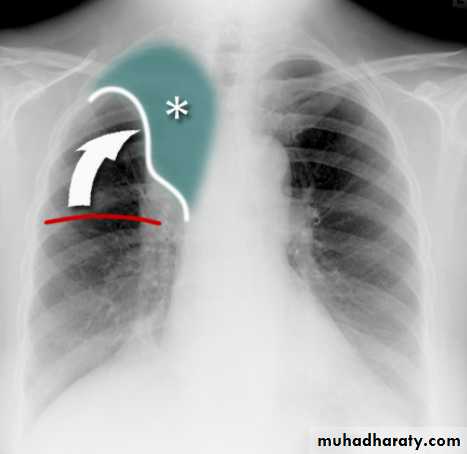Chest Imaging