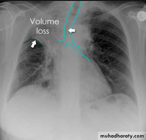 Chest Imaging