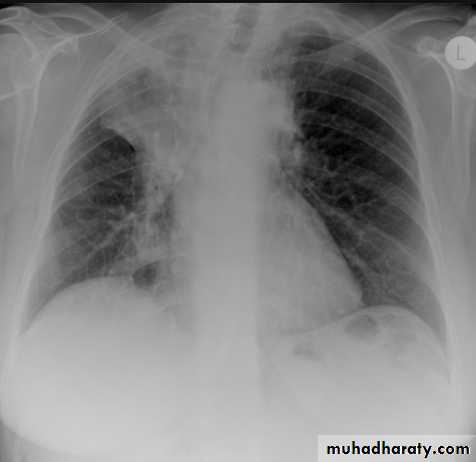 Chest Imaging