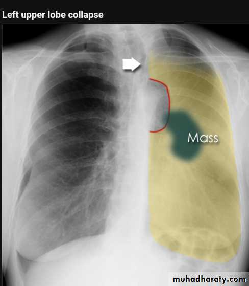 Chest Imaging